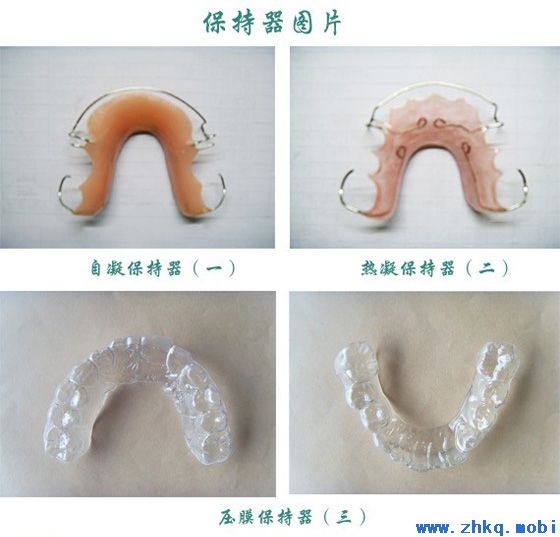 保持器的費用是多少？