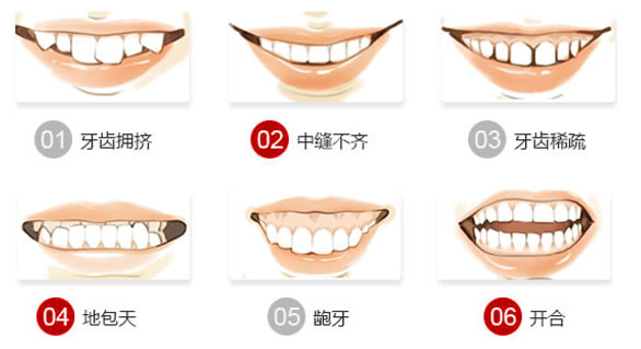 飲食不當(dāng)會(huì)造成牙齒畸形嗎？