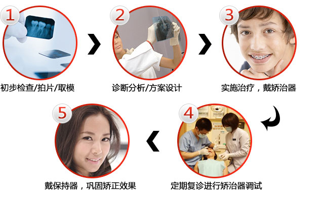 牙齒矯正的過程步驟有哪些？