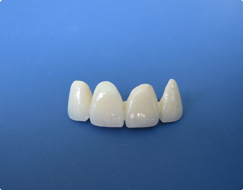 做完烤瓷牙后要注意什么？