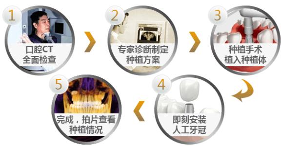 種植牙的過(guò)程是什么樣的？