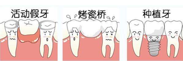 深圳鑲牙要多少錢？