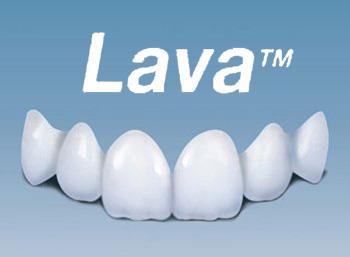 美國(guó)Lava全瓷牙好不好? 美國(guó)Lava全瓷牙好不好?