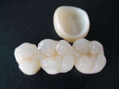 二氧化鋯全瓷牙價格表 二氧化鋯全瓷牙價格表